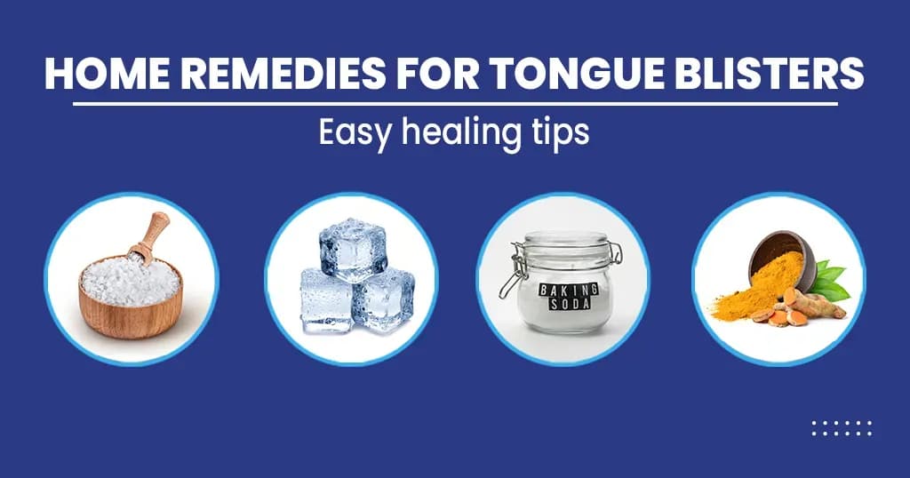 Home remedies of Tongue blisters 