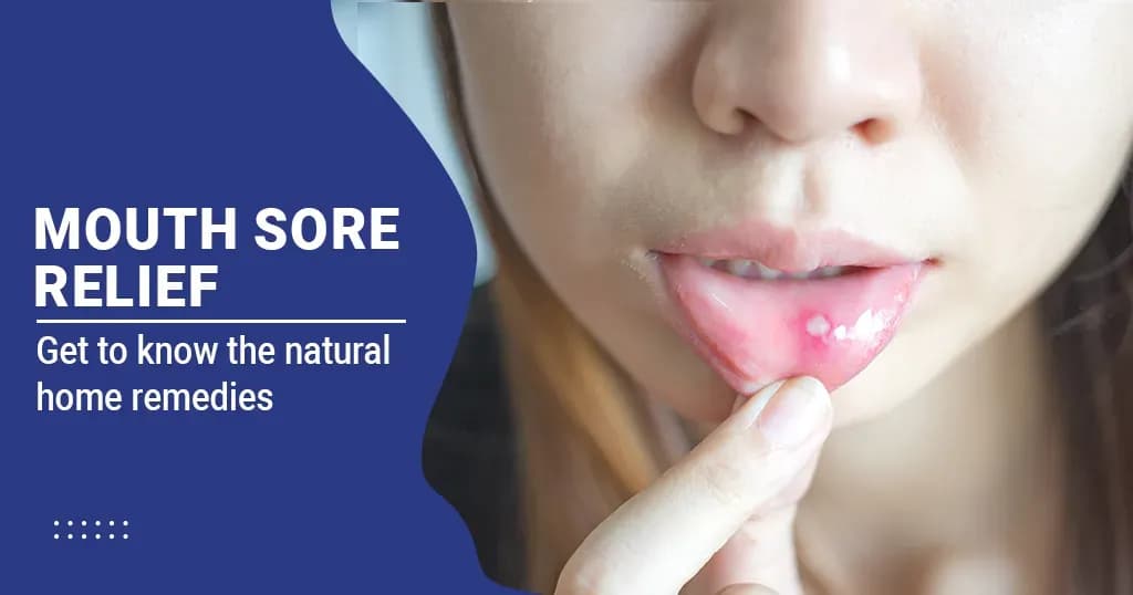 Natural Remedies for Mouth Sore Relief