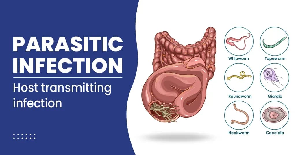 What is a parasitic infection?