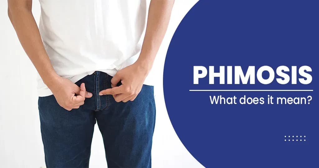 Phimosis - What is it? causes, symptoms and treatments