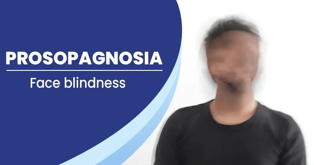 Prosopagnosia - Causes , Symptoms , Treatments , and more