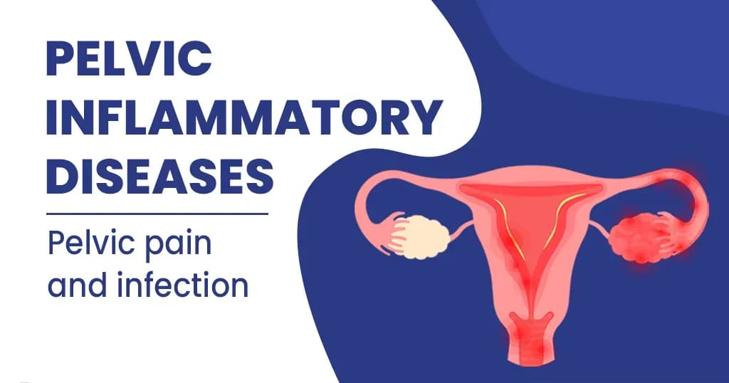 Pelvic Inflammatory Diseases - Causes and symptoms