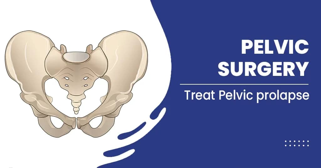 Pelvic surgery -Types , Symptoms, and Diagnosis