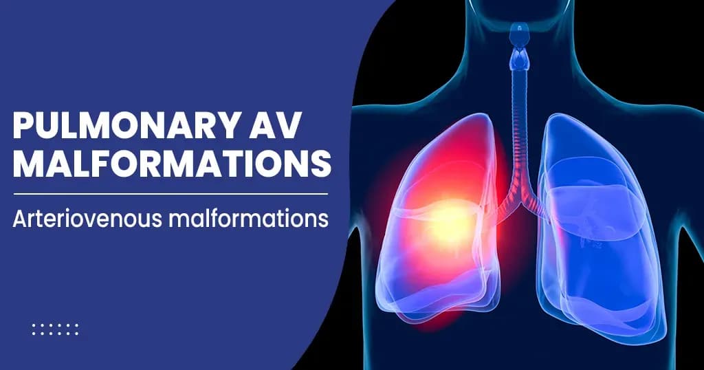 Pulmonary Arteria malformation 