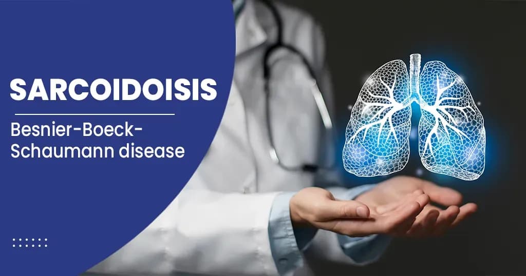 Sarcoidosis - Symptoms, Causes, Diagnosis, and Treatments