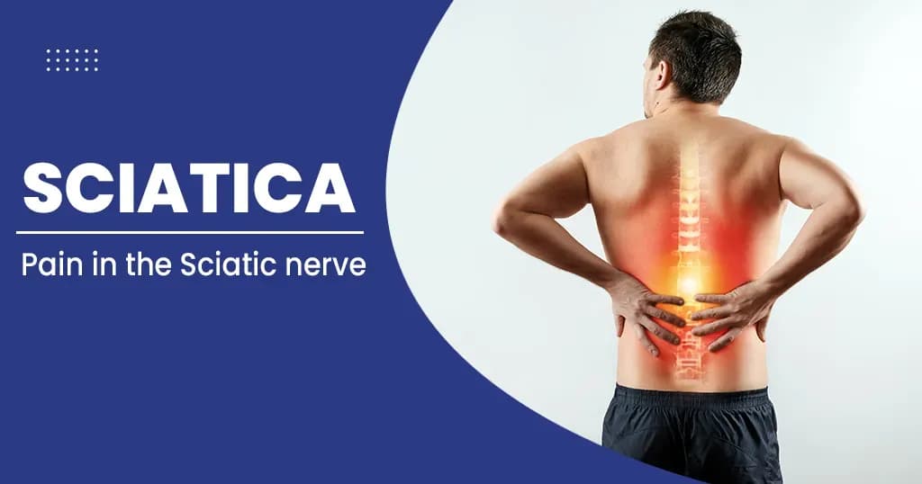 Sciatica - Symptoms, Causes, and How to Cure