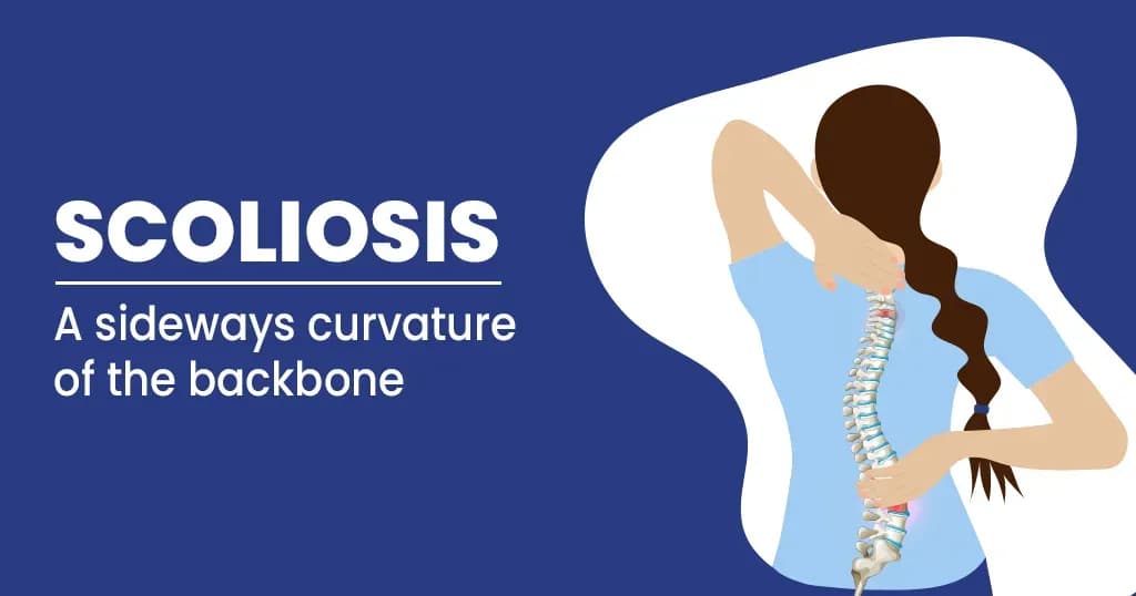 Scoliosis - causes, symptoms and treatment