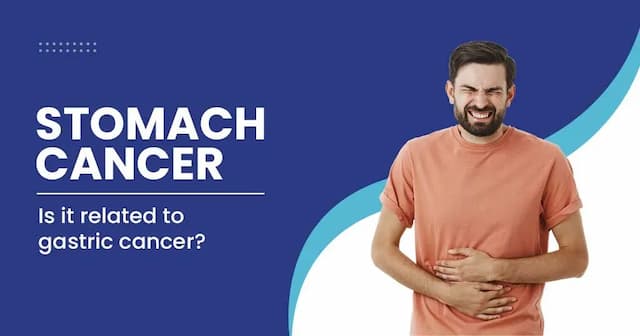 Stomach cancer