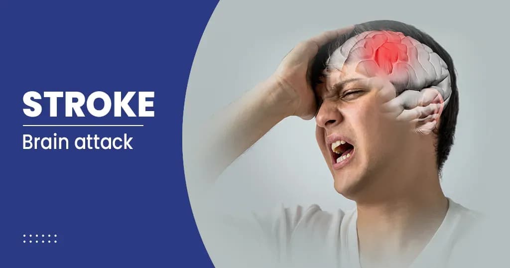 Stroke: Causes, symptoms and treatment