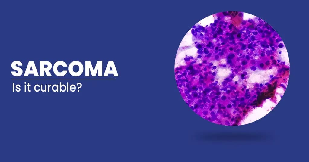 Sarcoma Symptoms, Types, Causes, Treatments