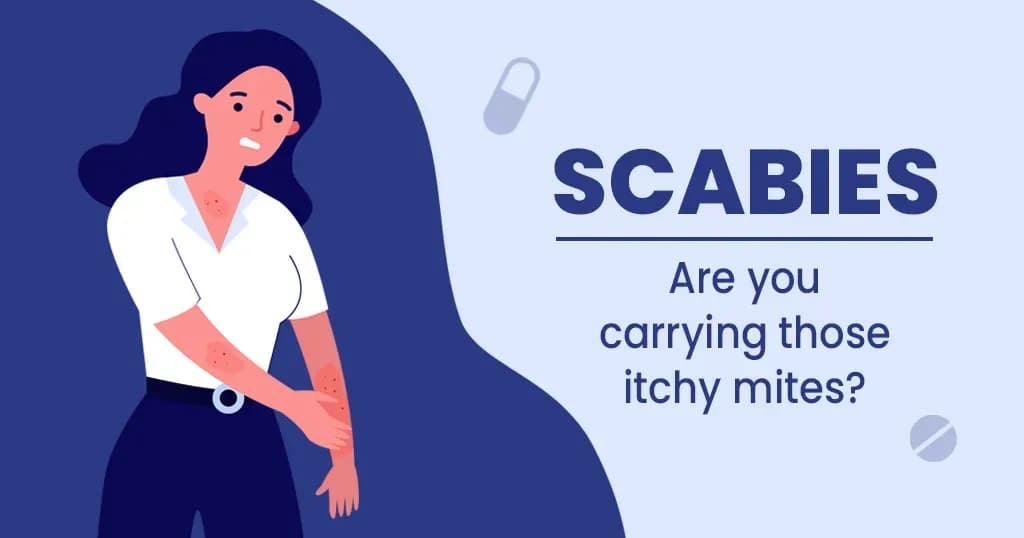 Scabies symptoms and treatment