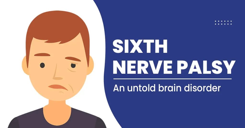 Sixth Nerve Palsy- causes, symptoms, and treatment