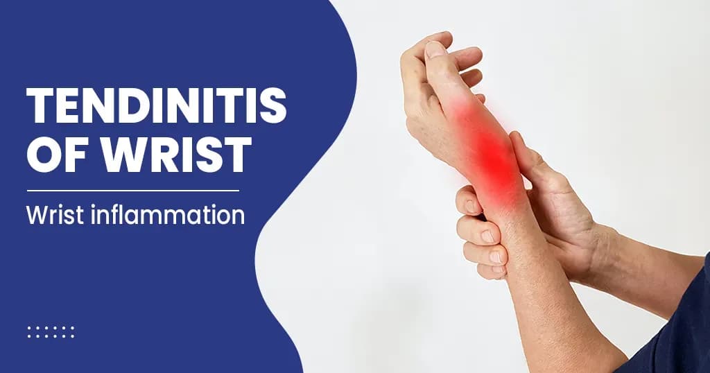 Tendinitis of wrist-causes-symptoms-risk-factors-and-more