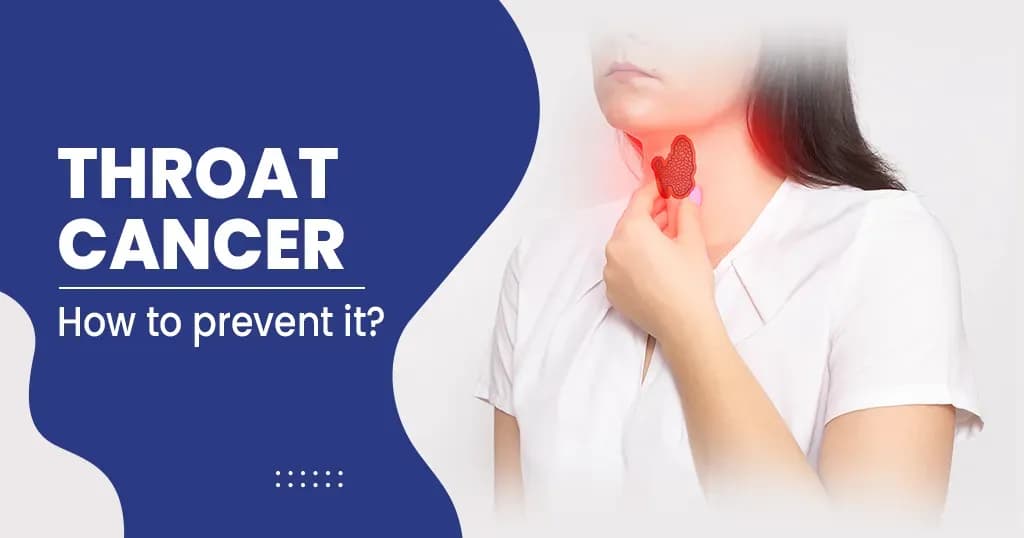 Throat cancer - Symptoms, Risk factors, Treatments, and more