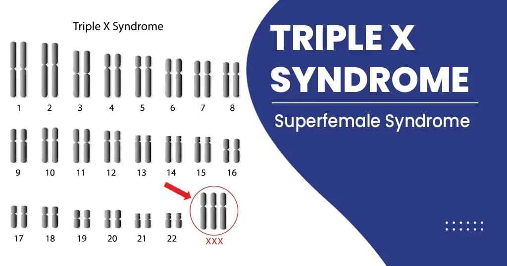 What is Triple X syndrome?