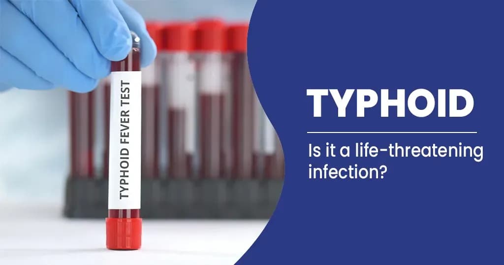 Typhoid - Symptoms and Preventions