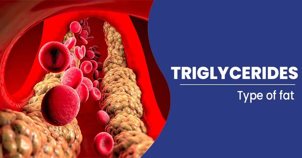 Triglycerides - Why do they really matter?