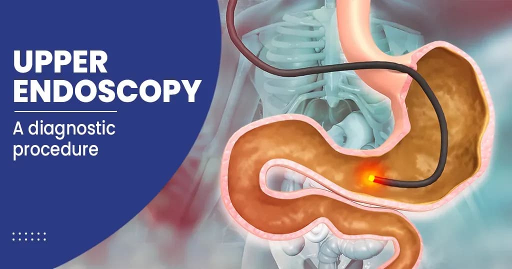 Upper Endoscopy