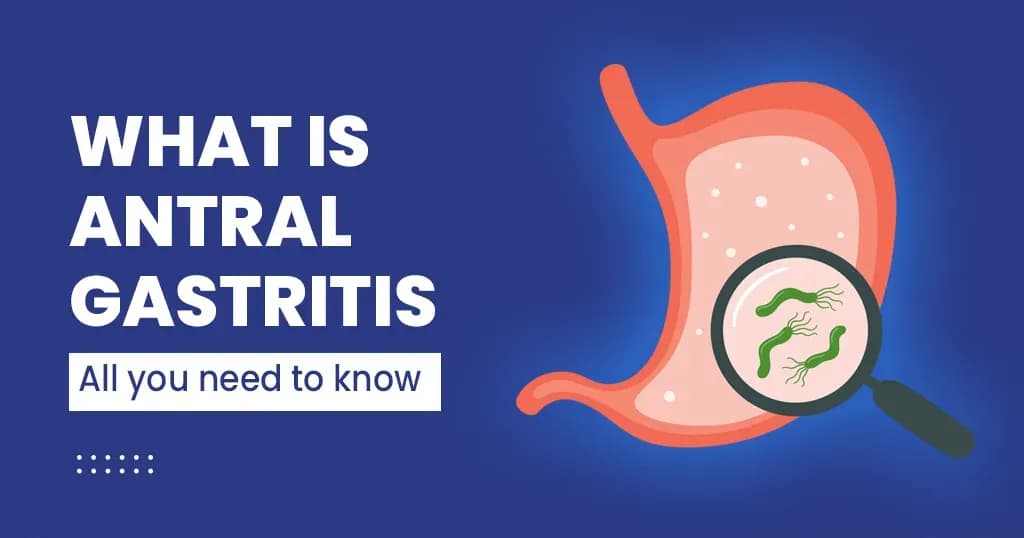 What is Antral Gastritis - All you need to know