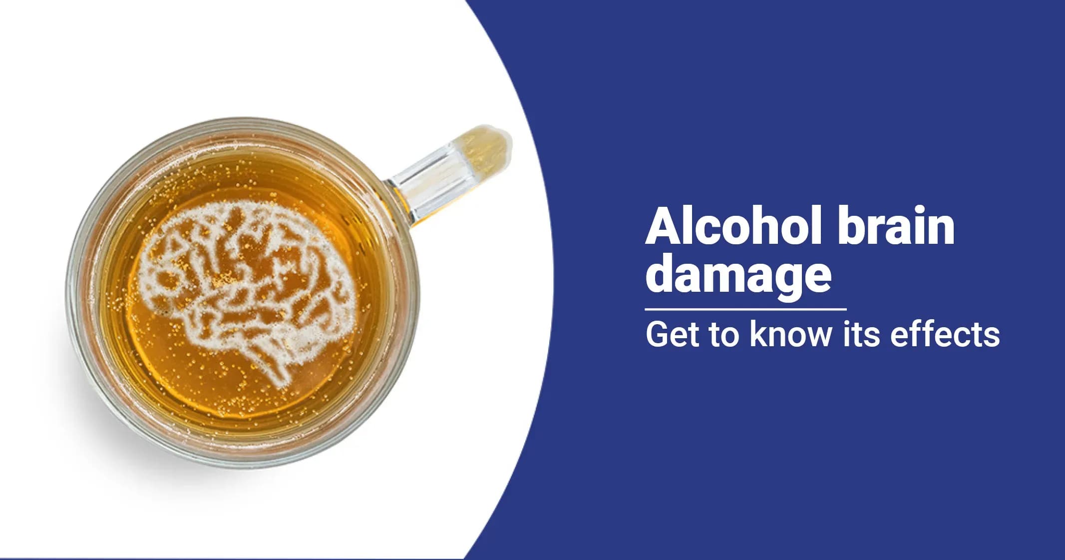 What are the Effects of Alcohol Brain Damage?