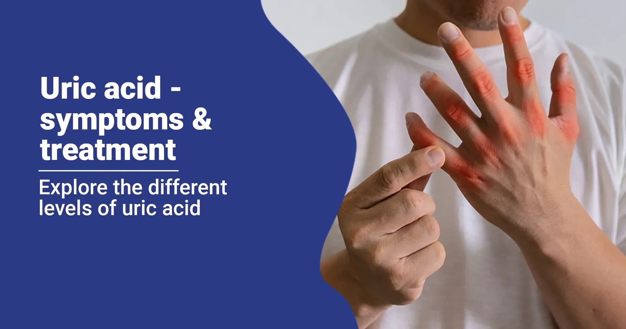 Uric Acid - Causes, Prevention & Treatment