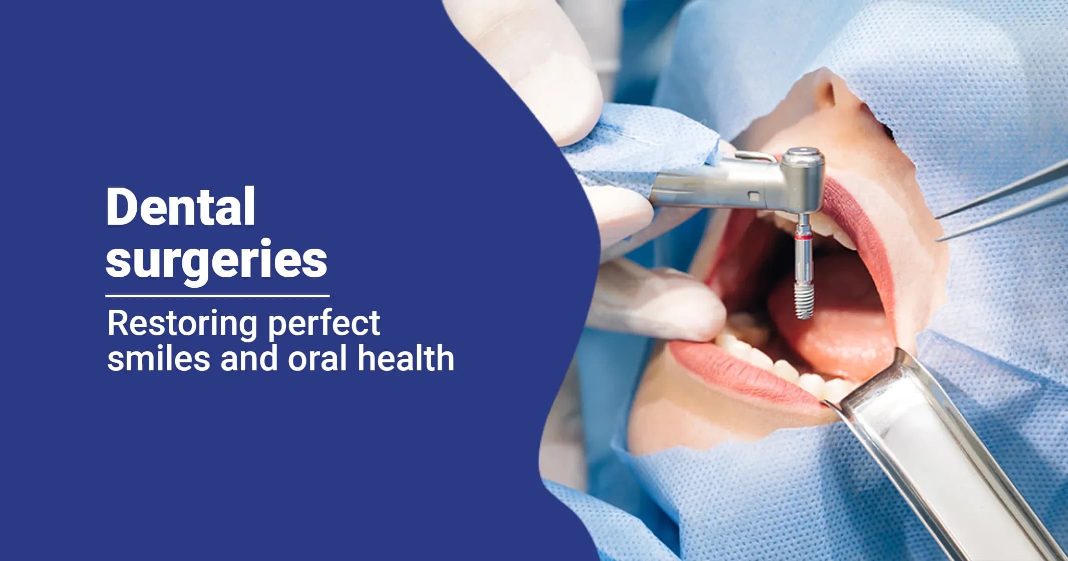 Dental Surgeries That Can Restore Your Smile and Oral Health