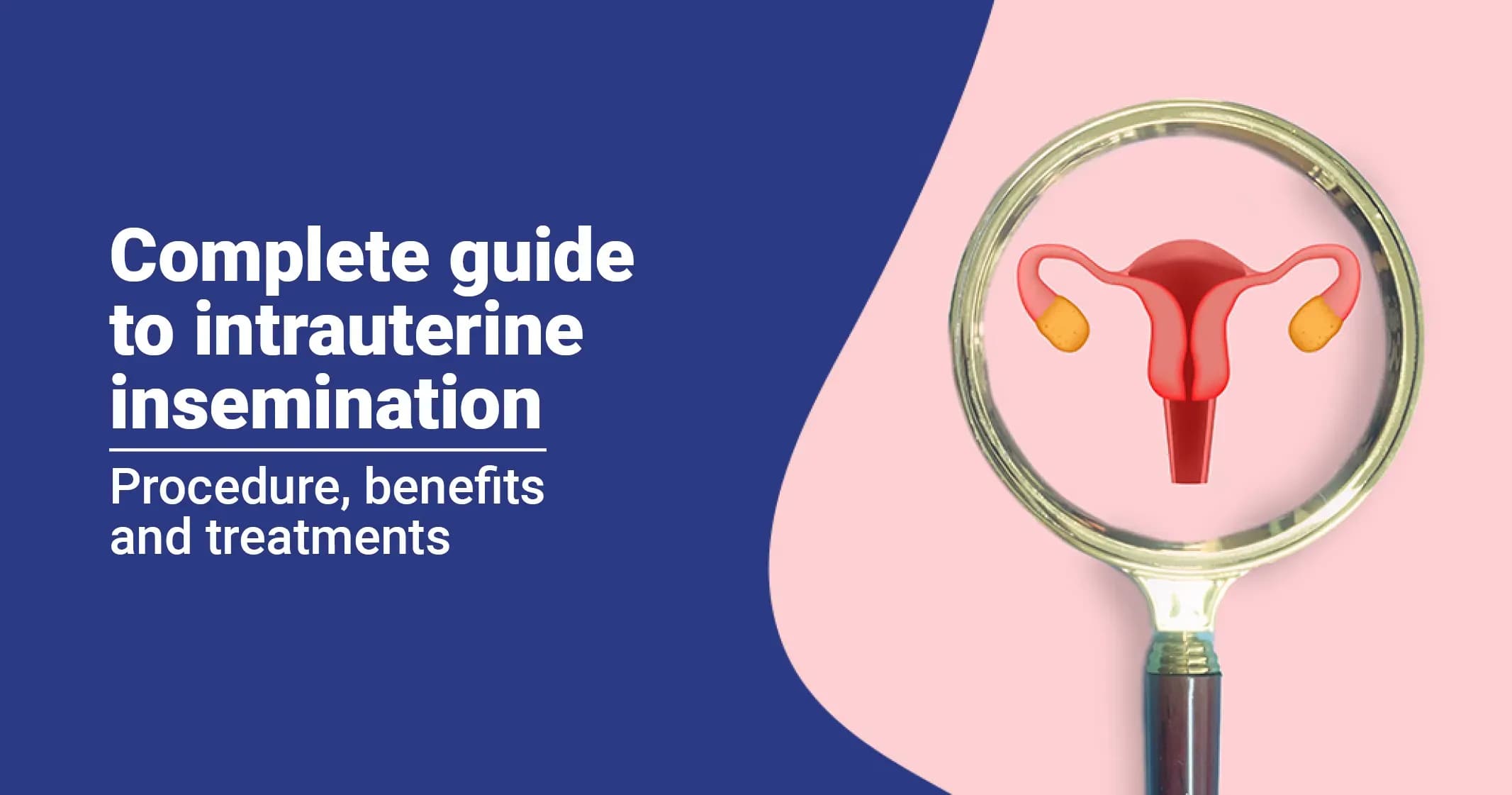 Your Complete Guide to Intrauterine Insemination