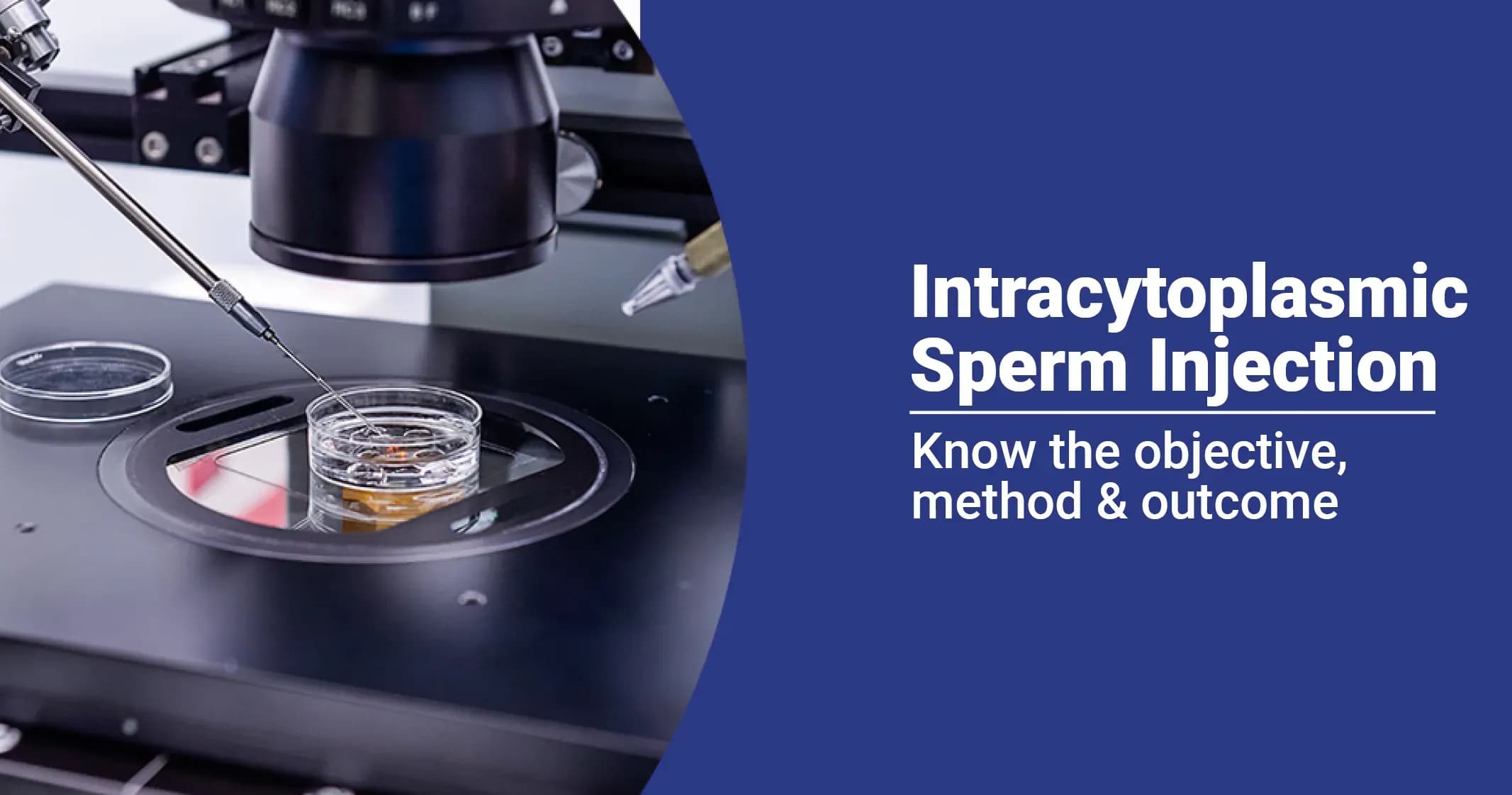 Intracytoplasmic Sperm Injection (ICSI)