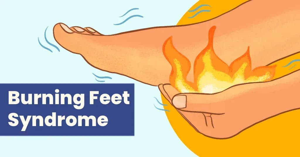 Burning Feet Syndrome - Causes, diagnosis and treatments