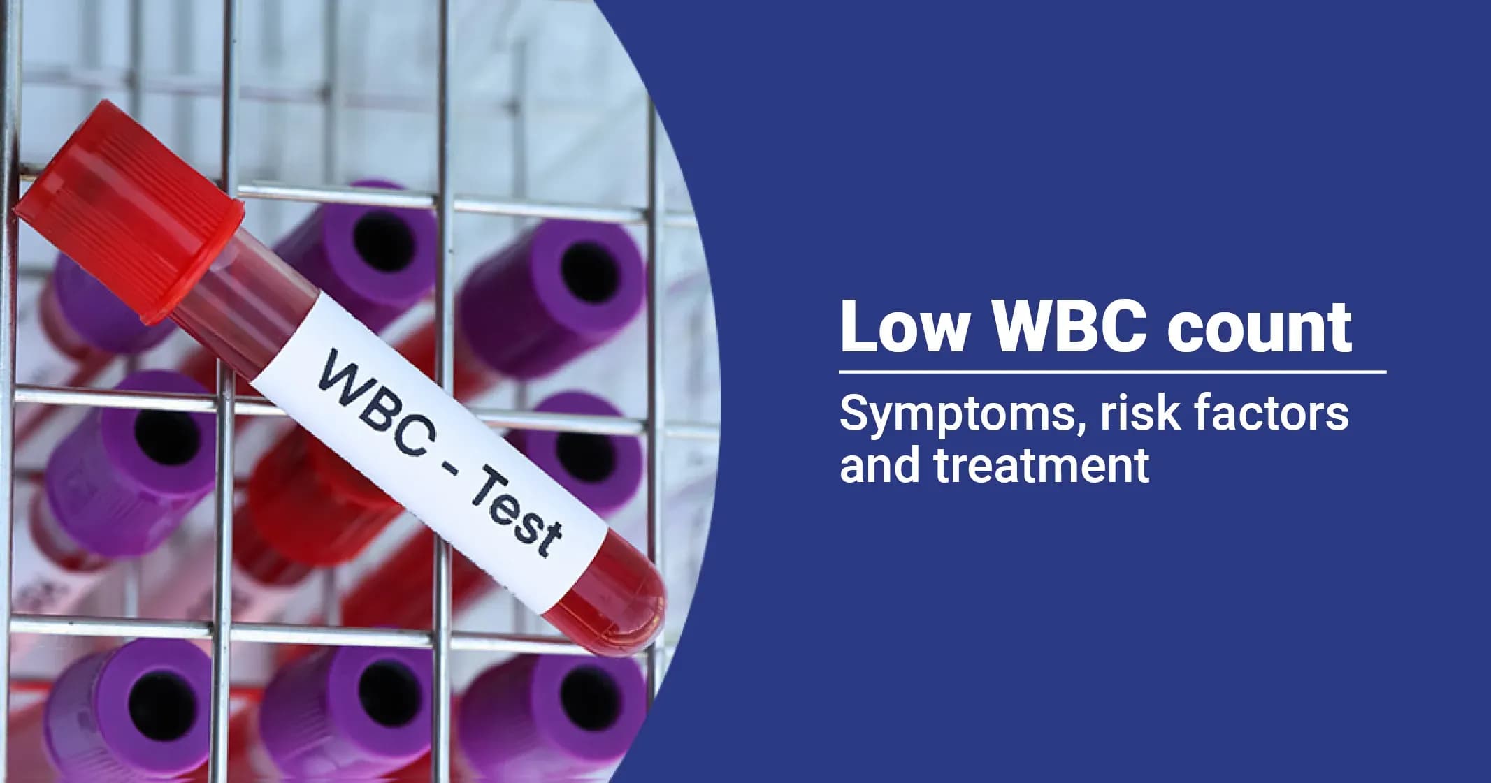 The dangers of low white blood cell counts: How to protect yourself