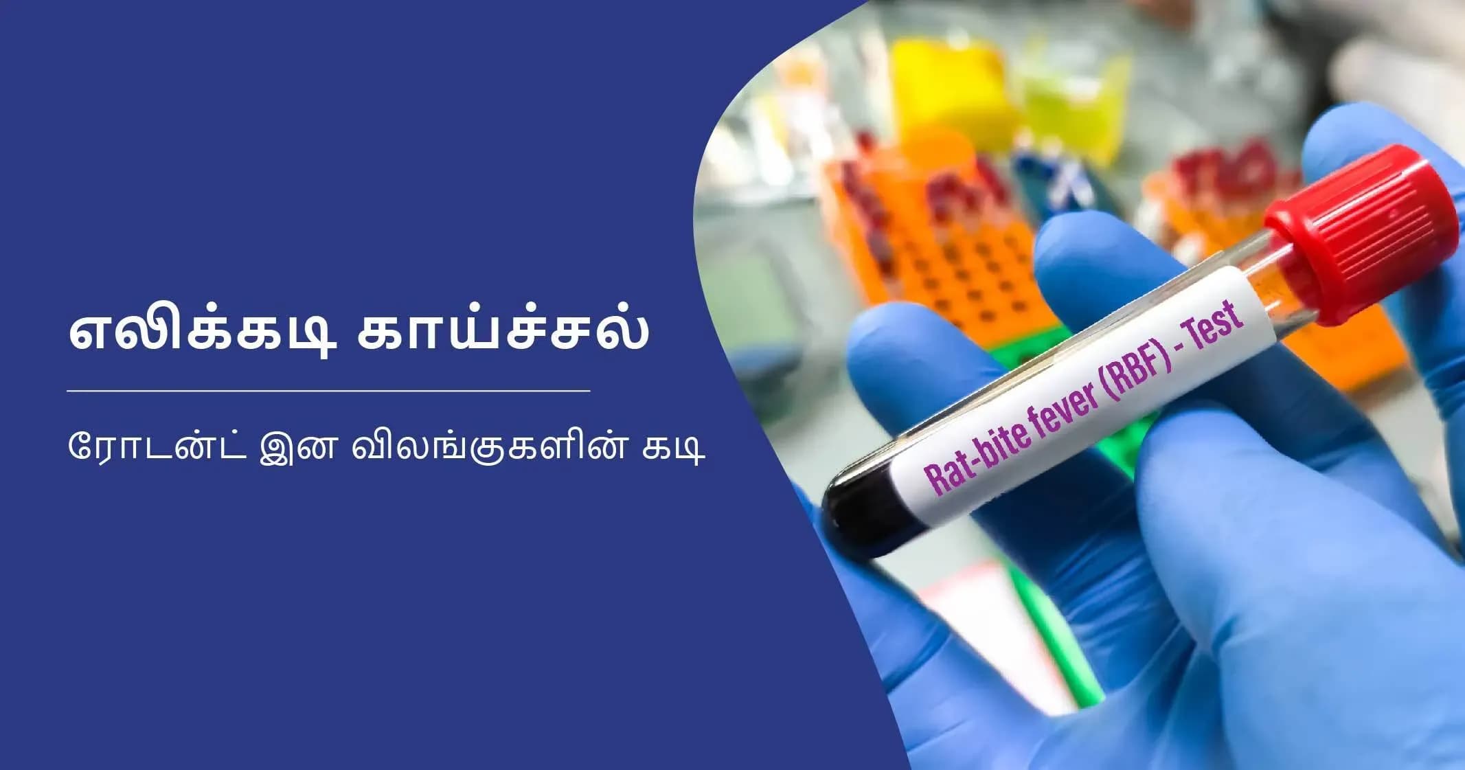 எலிக்கடி காய்ச்சலின் அறிகுறிகள், காரணங்கள் மற்றும் அதற்கான சிகிச்சைகள்