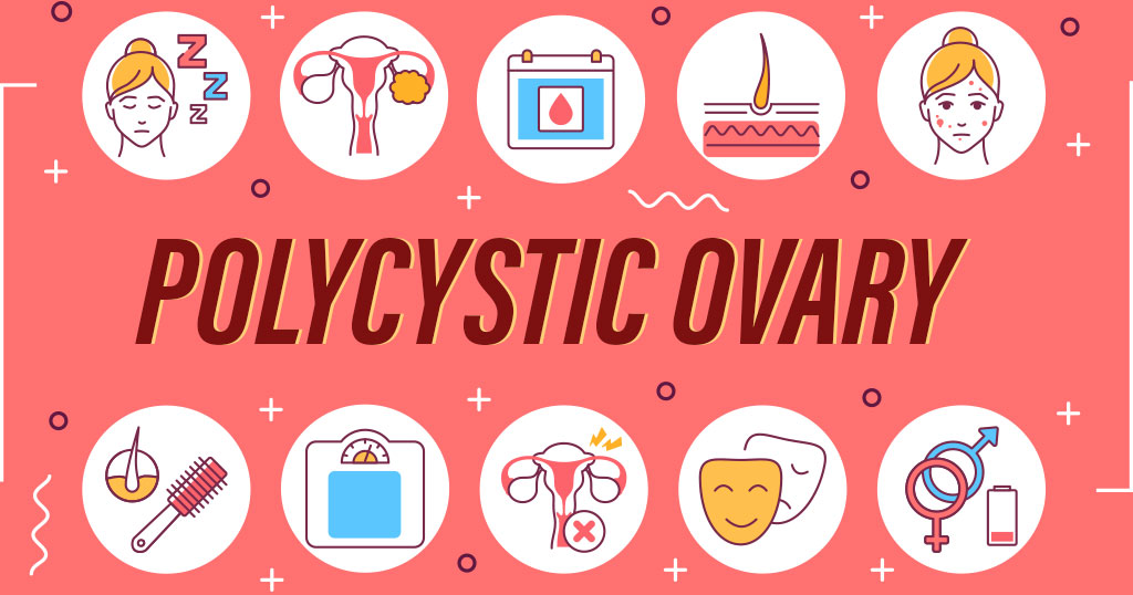 Polycystic-Ovary