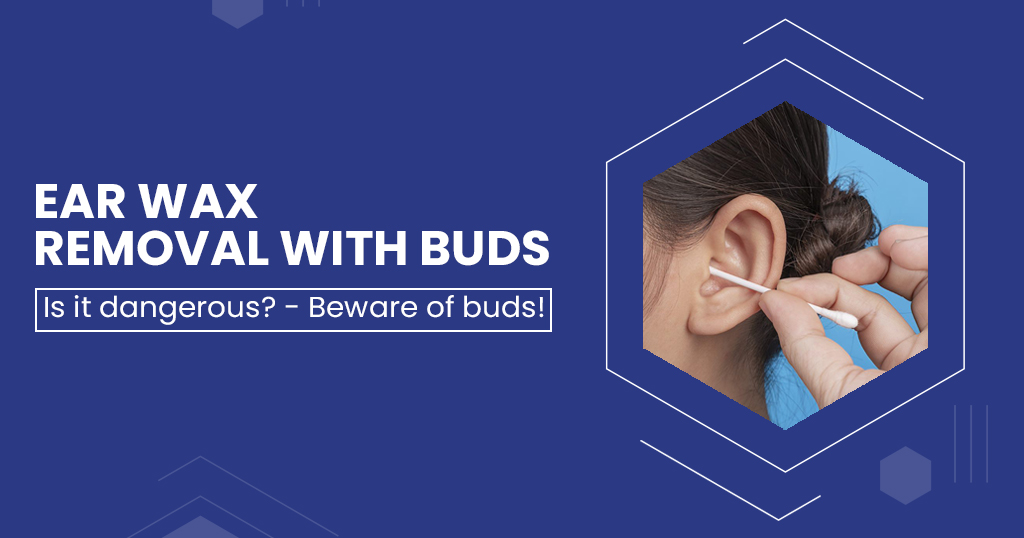 EAR WAX REMOVAL WITH BUDS