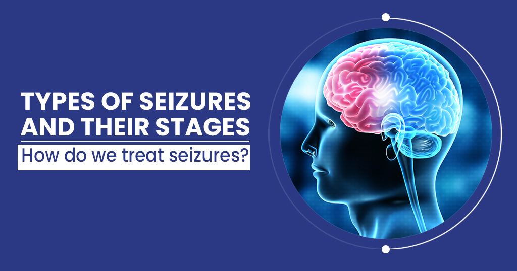 types of seizures