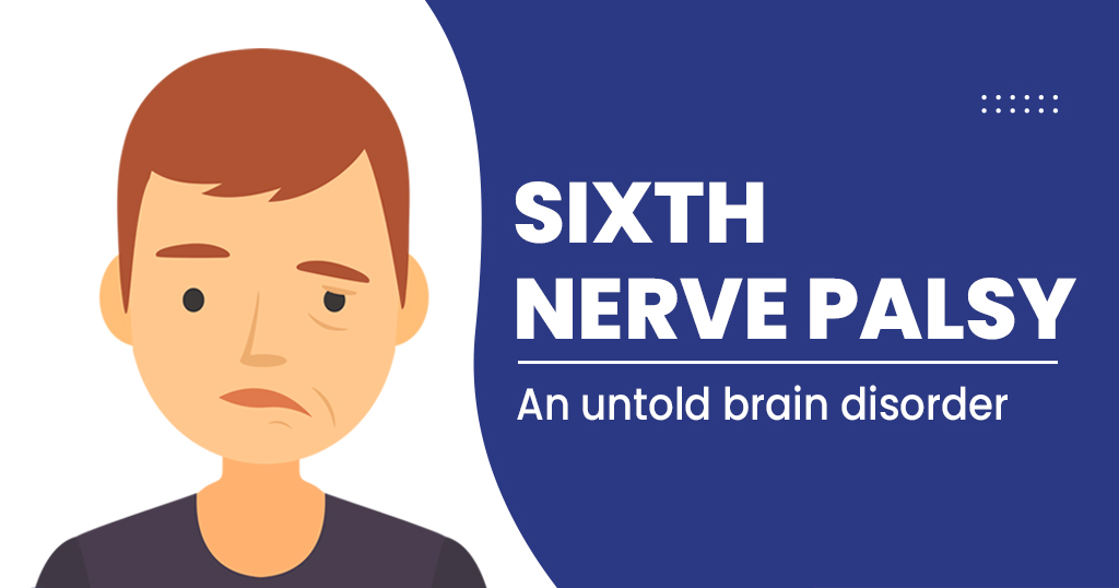 Sixth nerve palsy