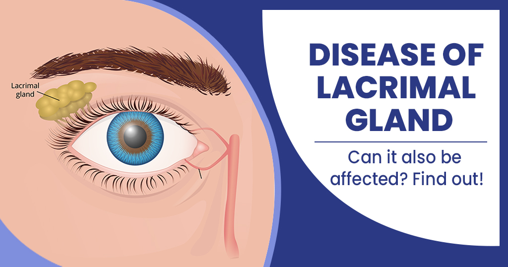 Disease of lacrimal gland