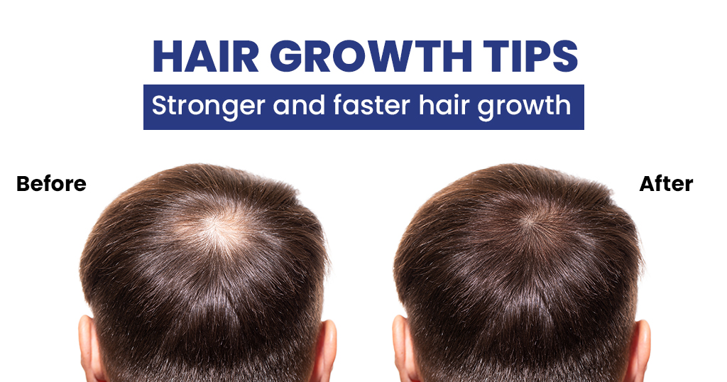 Share more than 80 human hair growth latest - in.eteachers