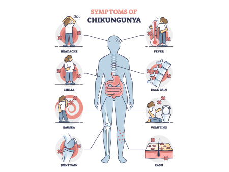 Symptoms of chikungunya