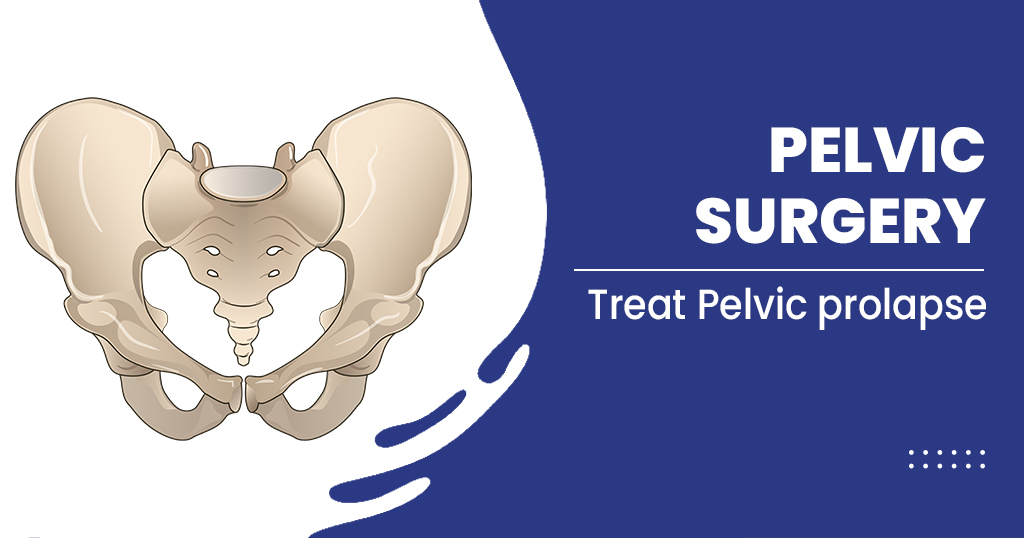 Pelvis Surgery