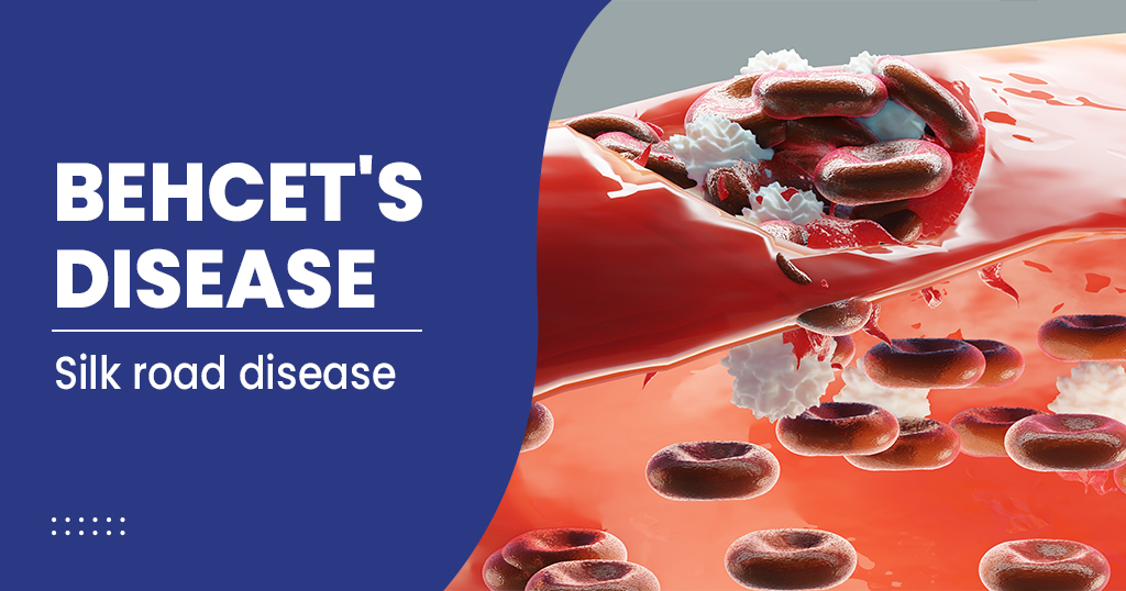 Behcet Disease Causes Symptoms And Treatment