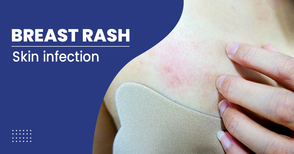 What Could A Rash On Your Breast Mean?