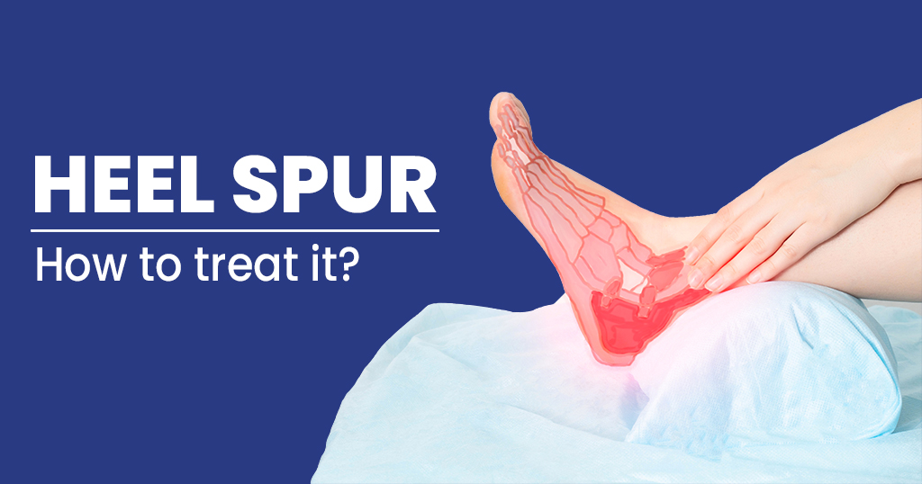 Heel Spur Removal - Foot - Surgery - What We Treat - Physio.co.uk