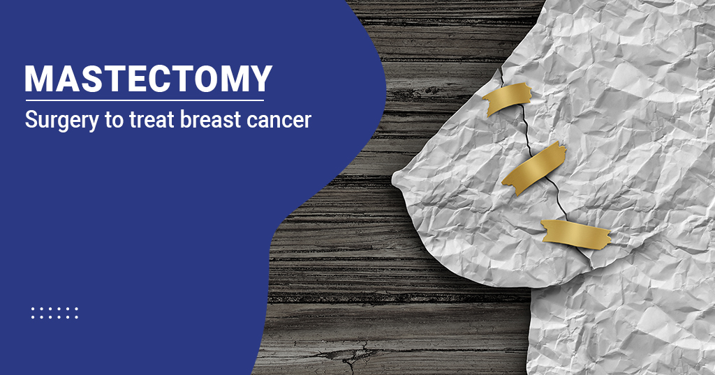 Mastectomy Breast Removal Surgery Types And Procedure