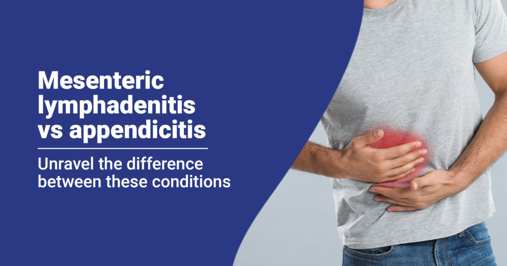 Mesenteric lymphadenitis vs appendicitis