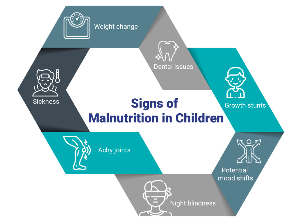 Signs of malnutrition in kids