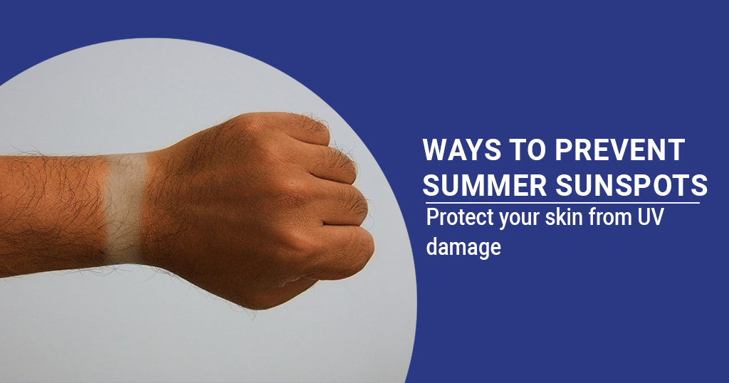 Ways to Prevent Summer Sunspots