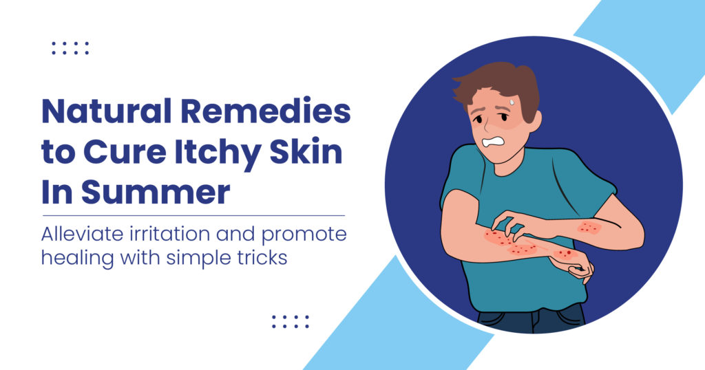 Natural Remedies to Cure Itchy Skin in Summer